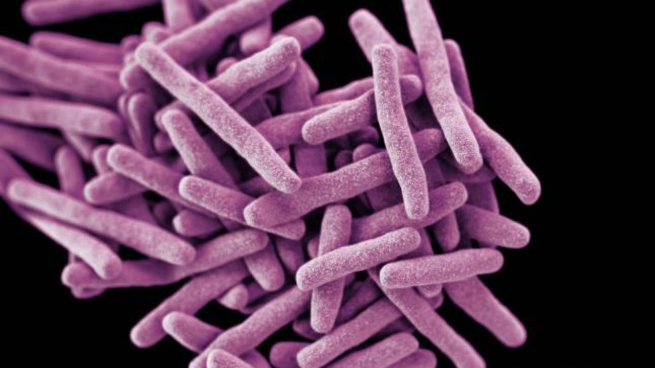 Tuberculosis almost disappeared in the majority of the Western world as countries developed. But the disease persists globally, with an estimated <a href="http://www.who.int/mediacentre/factsheets/fs104/en/" target="_blank" target="_blank">9.6 million people developing TB in 2014 and 1.5 million dying from it. </a><br /><br />The bacterium behind the disease, Mycobacterium tuberculosis, has developed into multidrug resistant (MDR) forms, which require an additional pool of more toxic drugs to treat it. In 2014, there were 480,000 cases of MDR-TB worldwide and extensively drug-resistant (XDR) TB had been reported in 100 countries.<a href="http://edition.cnn.com/2014/05/28/health/return-white-plague-incurable-tb/" target="_blank"> India is one country that reported patients with total resistance to all drugs available.</a> With few new drugs in the pipeline to control the bacteria, total resistance could spread.