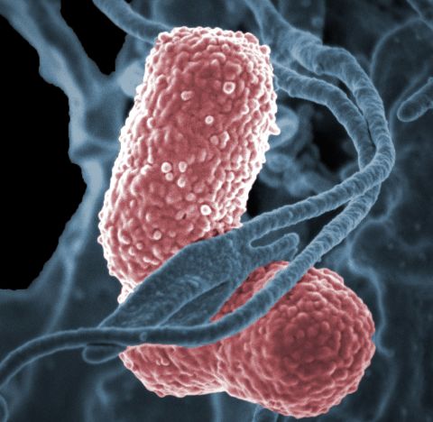 Klebsiella bacteria have also developed a high level of resistance to antibiotics, such as <a href="http://www.cdc.gov/hai/organisms/cre/index.html" target="_blank" target="_blank">carbapenem</a>. The bacteria naturally occurs in the intestines where it does not usually cause disease, but it can cause pneumonia, bloodstream infections and meningitis.<br /><br />It's unlikely that healthy people are affected by the bacteria, but <a href="http://www.cdc.gov/HAI/organisms/klebsiella/klebsiella.html" target="_blank" target="_blank">patients in hospitals</a> who use a ventilator, intravenous catheters or long courses of certain antibiotics are at higher risk of becoming infected. 