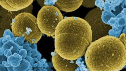 Scanning electron micrograph of S. aureus bacteria escaping destruction by human white blood cells. Credit: NIAID