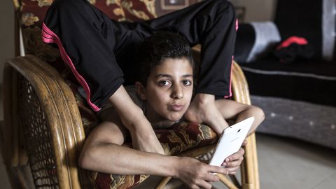 Mohammed is known for his almost unbelievable body contortions.