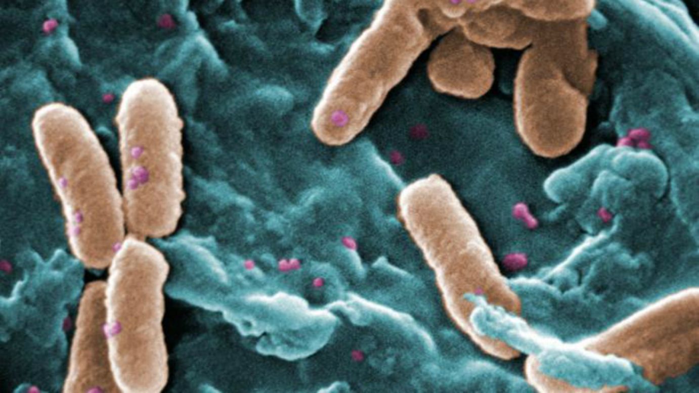 Pseudomonas bacteria can be deadly for patients who are in critical care. According to CDC it's the cause of about <a href="http://www.cdc.gov/hai/organisms/pseudomonas.html" target="_blank" target="_blank">51,000 healthcare-associated infections in the United States</a> each year. More than 6,000 of these cases are multi-drug resistant, leading to around 400 deaths per year. The most serious Pseudomonas infections usually occur in hospitals, affecting patients who are on breathing machines, using catheters or with wounds from surgery.<br />