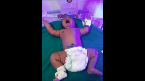 The baby was twice the size of the average Indian newborn.