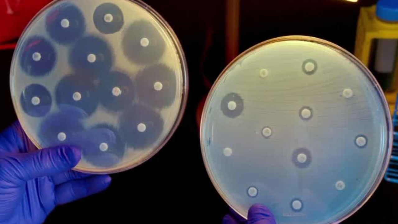 cdc director superbug antibiotics frieden intv_00003313.jpg