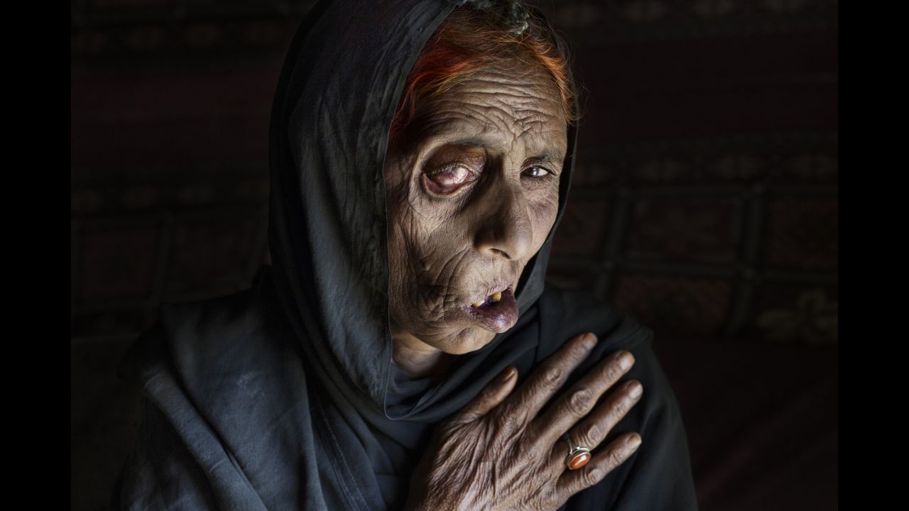 Naiz Bibi, blind in one eye, lost seven members of her family in an airstrike, including her husband, daughter and two sons. She is photographed here in April 2015.