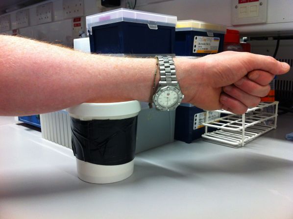 To understand more about the disease in humans, and to test the protective effect of vaccines, Hill's team expose willing volunteers to bites by mosquitoes infected with malaria. Here, a volunteer lays his arm on top of a cup containing mosquitoes.