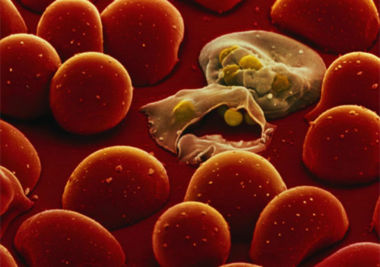 The life cycle of the malaria parasite is complex and has many stages of development inside the human body. One stage is their transformation into 'merozoites' where they infect blood cells and replicate inside them, growing in number until the cells burst (pictured) releasing them into the bloodstream to infect more cells.