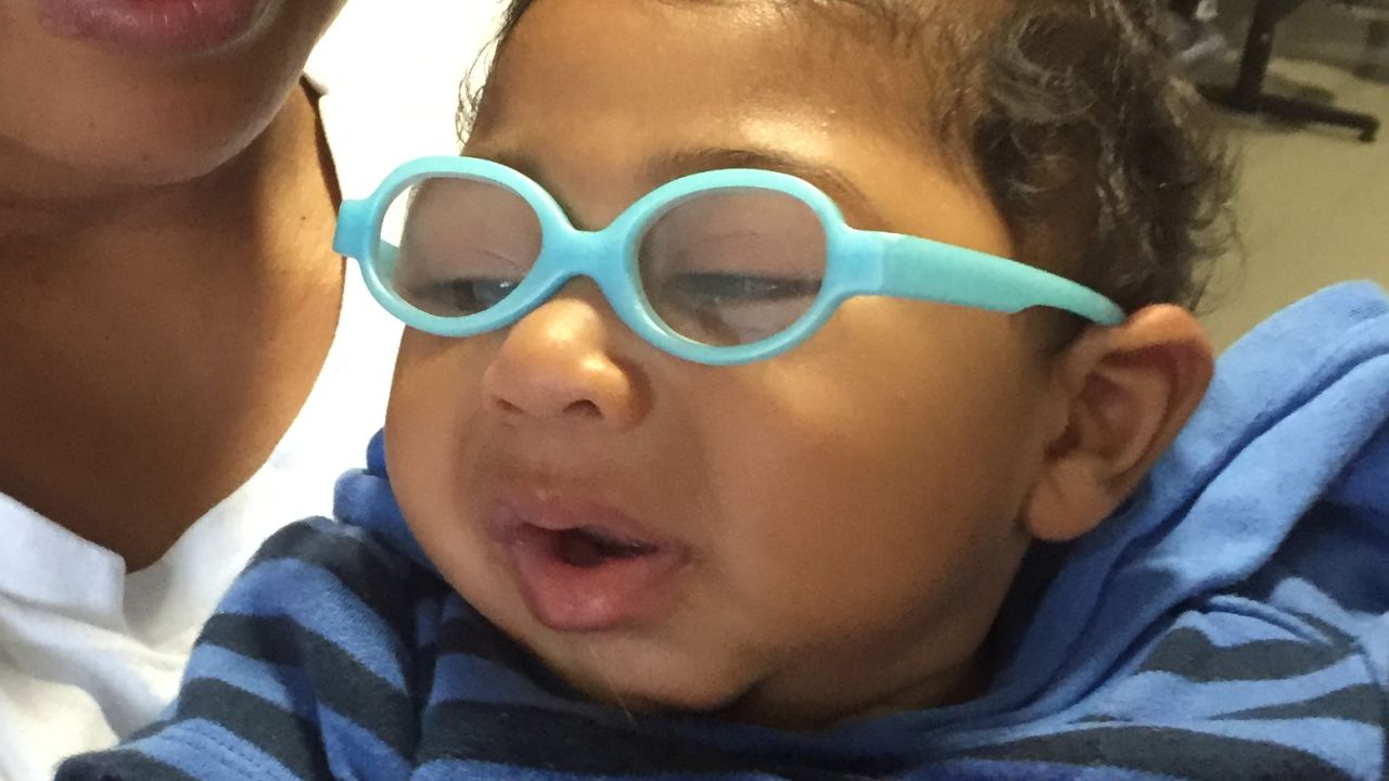 A mother and her baby, who has microcephaly, at the Altino Ventura Foundation Clinic in Recife, Brazil.