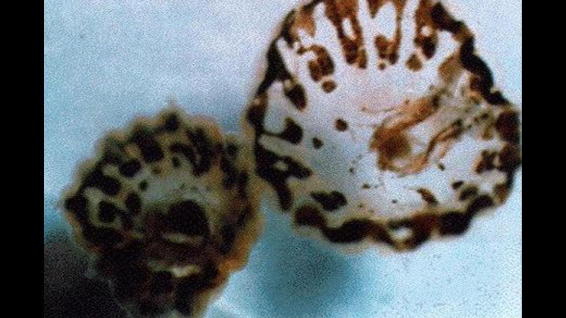 Sea lice are not lice at all by the microscopic larvae of marine life.