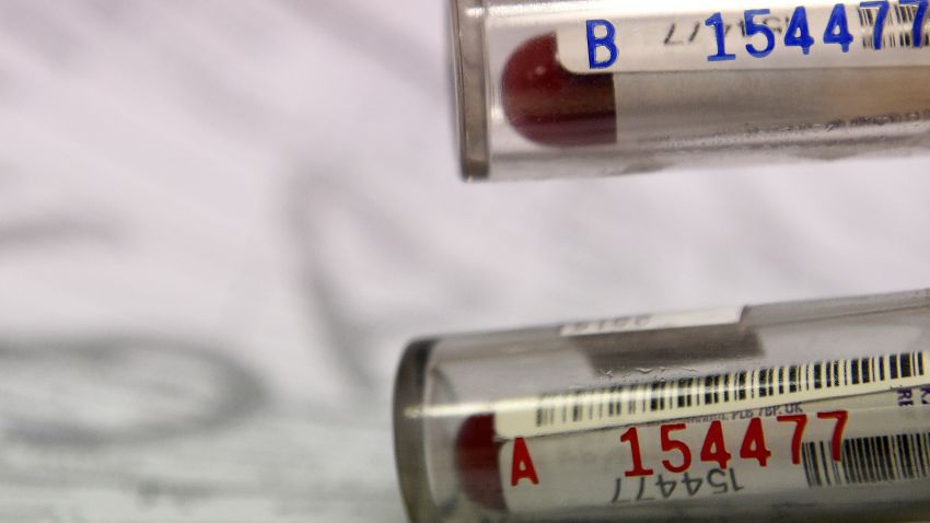 A picture taken on December 15, 2015 shows two blood samples of an athlete about to be analyzed at the French national anti-doping laboratory, in Chatenay-Malabry, outside Paris.  / AFP / FRANCK FIFE        (Photo credit should read FRANCK FIFE/AFP/Getty Images)