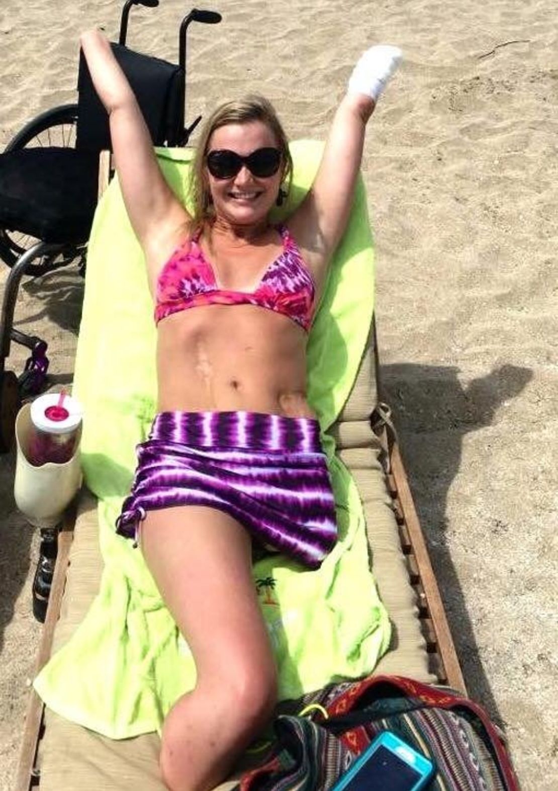 Copeland reclines this year at a beach during a family vacation in San Juan, Puerto Rico. "It has taken me a long time to become comfortable with and accept my new body," she wrote when posting this picture to Facebook in June. "We are ALL made with imperfections and there is so much beauty in our flaws. The scars and skin grafting build character! It's not about what you have -- what you do with what you have is what really counts."