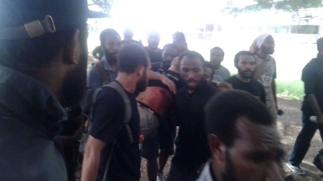 Injured protesters in Port Morseby.