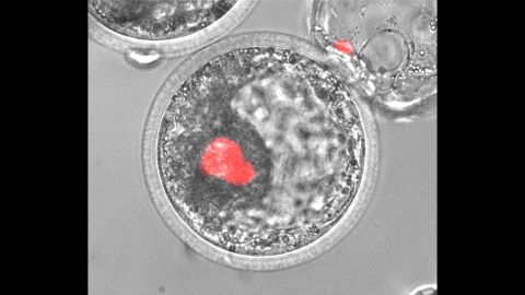 This microscopic image shows human induced pluripotent stem cells, colored red, integrated into a pig embryo. Scientists hope these human cells can be harnessed to create organs for transplant patients one day.