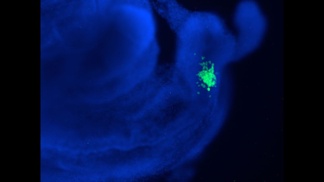 In this human-mouse chimeric embryo, the human stem cells are shown in green and mouse cells are blue. Early in the research, scientists focused on integrating human cells into mouse embryos. However, pigs are now a preferred animal because their organs are roughly the same size as humans'.