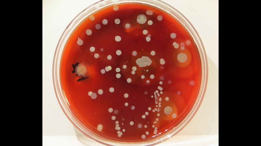 Three types of bacteria were found on a utility doorknob. One of the species, Streptococcus, is responsible for various types of infections including strep throat.
