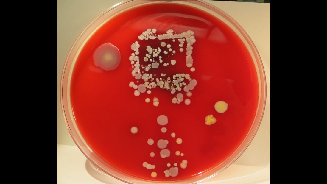 Staphylococcus species were found on one health-care worker's mobile phone. This species can sometimes lead to serious infections, such as pneumonia. Three other types of bacteria were also identified on the phone's surface.