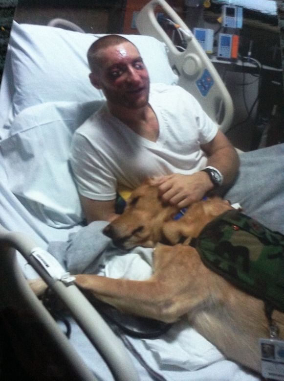 Snyder, then 27, lost his sight and had multiple operations on his face and eyes. From then on, he relies on his service dog, Gizzy, to guide him on the streets of Baltimore, where he now lives.
