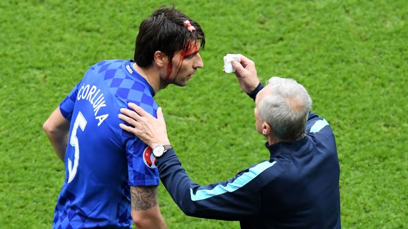 Croatian defender Vedran Corluka receives treatment after receiving a cut to the head.