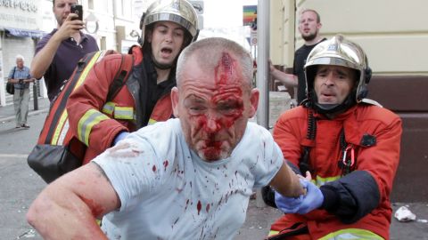 An English supporter injured after a street brawl is helped by a rescue squad ahead of the Euro 2016 football match between England and Russia, 