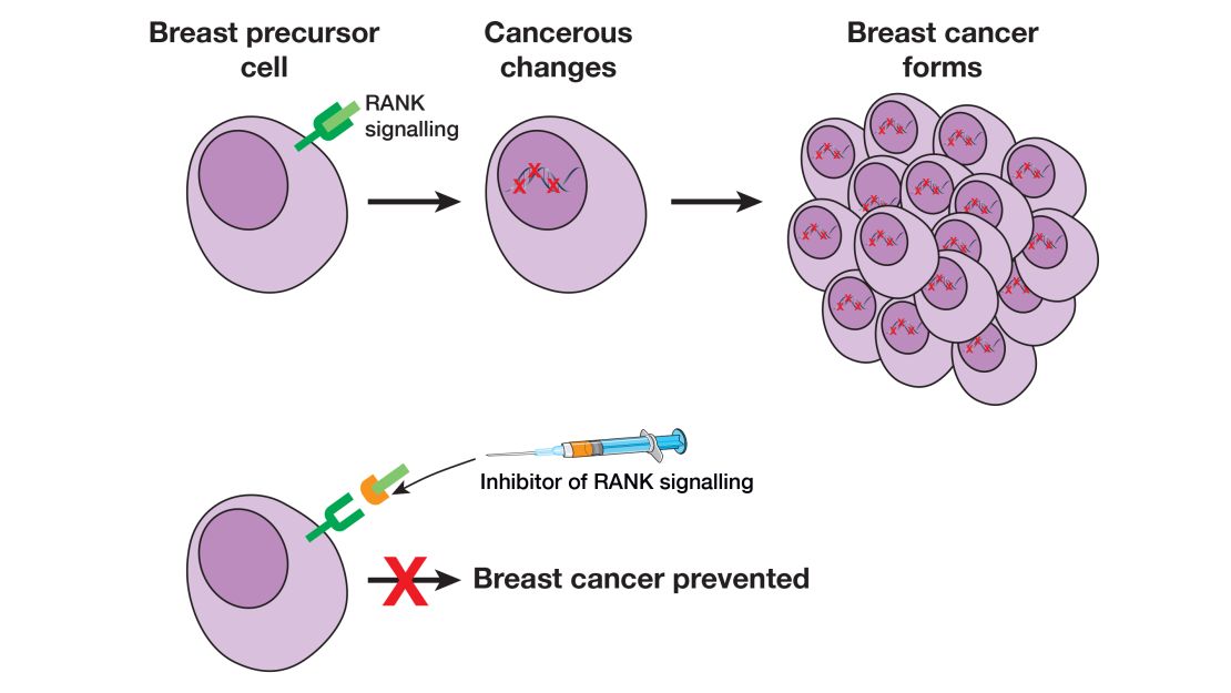 Researchers found that an existing drug might block breast cancer in women with BRCA1 gene.