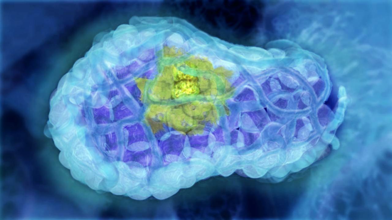 The beginnings of a breast tumor are shown in green in this visualization.