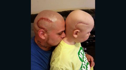 Josh Marshall's tattoo matches the scar on his son's head.