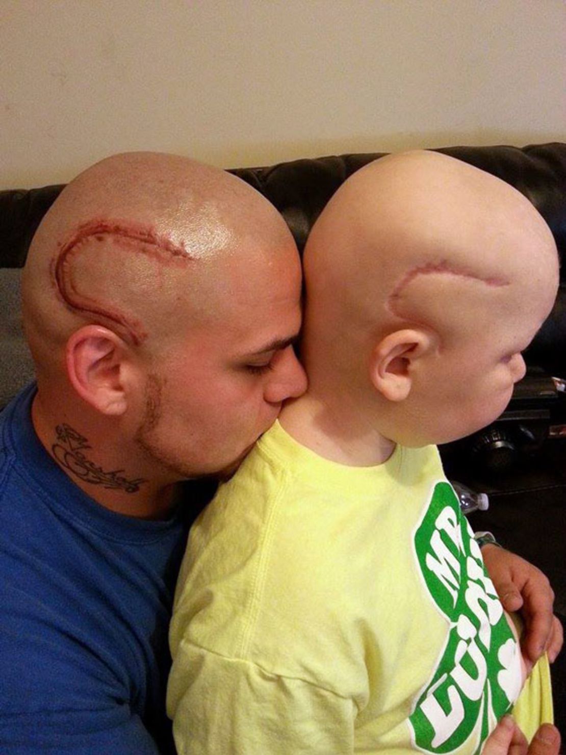 Josh Marshall's tattoo matches the scar on his son's head.