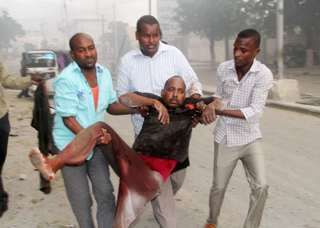 Somali men help a wounded civilian. Most of those killed and injured were civilians who were passersby and customers of nearby shops and the gas station, police said.