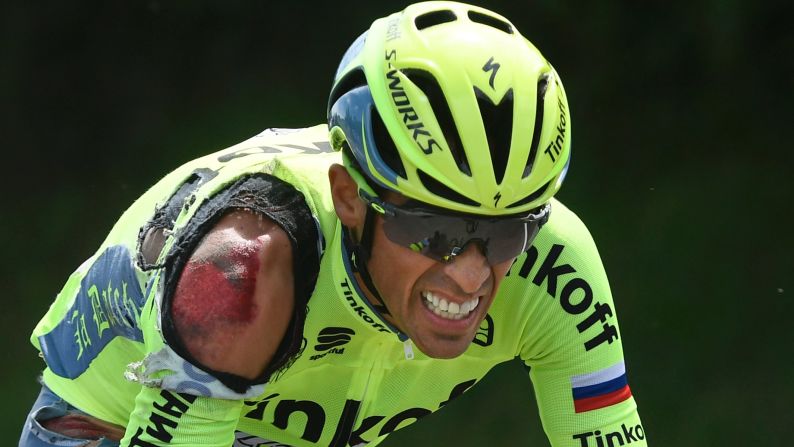 Alberto Contador, injured in a crash during the first stage of the Tour de France, grimaces as he rides to catch up with the pack on Saturday, July 2.