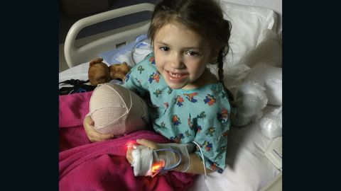 Katie had her last operation -- to amputate her leg -- in December 2015.