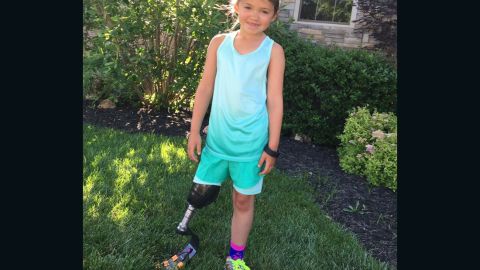 Katie has a special prosthesis for running.