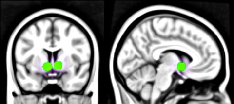 Being appreciated on social media, through "likes," was seen in brain scans to activate the reward centers of the brain, pictured.