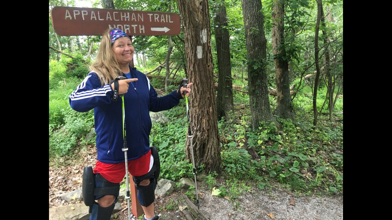 Stacey decided to hike the Appalachian Trail to show people how useful the braces are to insurance companies. She hopes her effort can make it easier for others to get the braces covered.