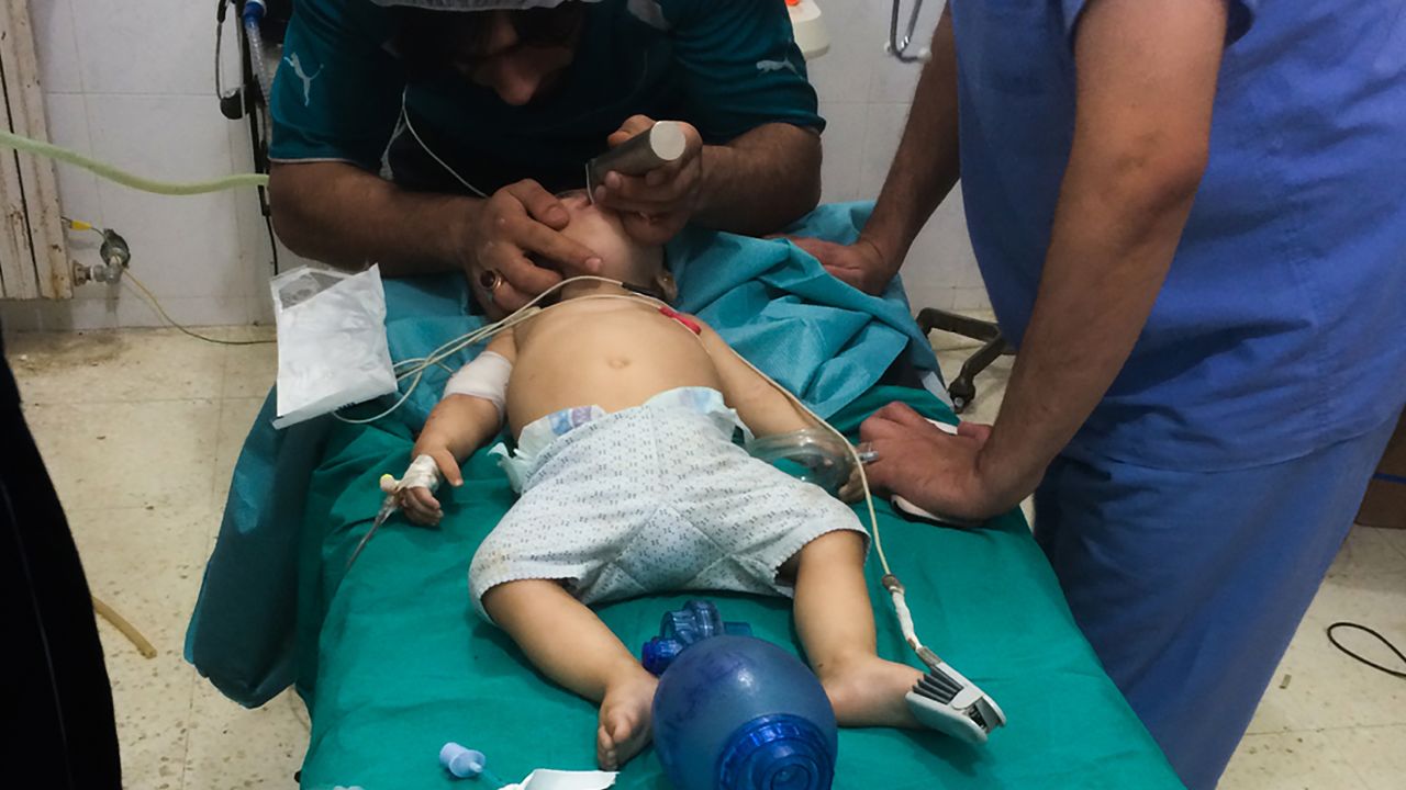 Doctors at the hospital treat an eight-month-old boy suffering from shrapnel wounds; he survived.