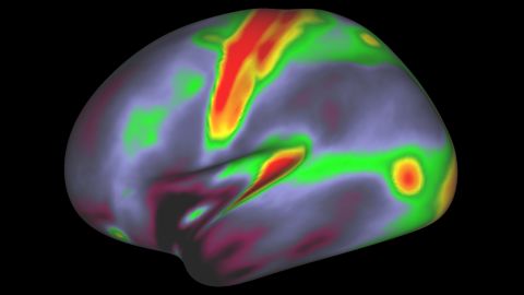 A 180-area multimodal human cortical parcellation on inflated left and right hemisphere surfaces.