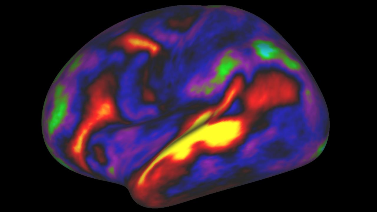 A 180-area multimodal human cortical parcellation on the left and right hemisphere surfaces.