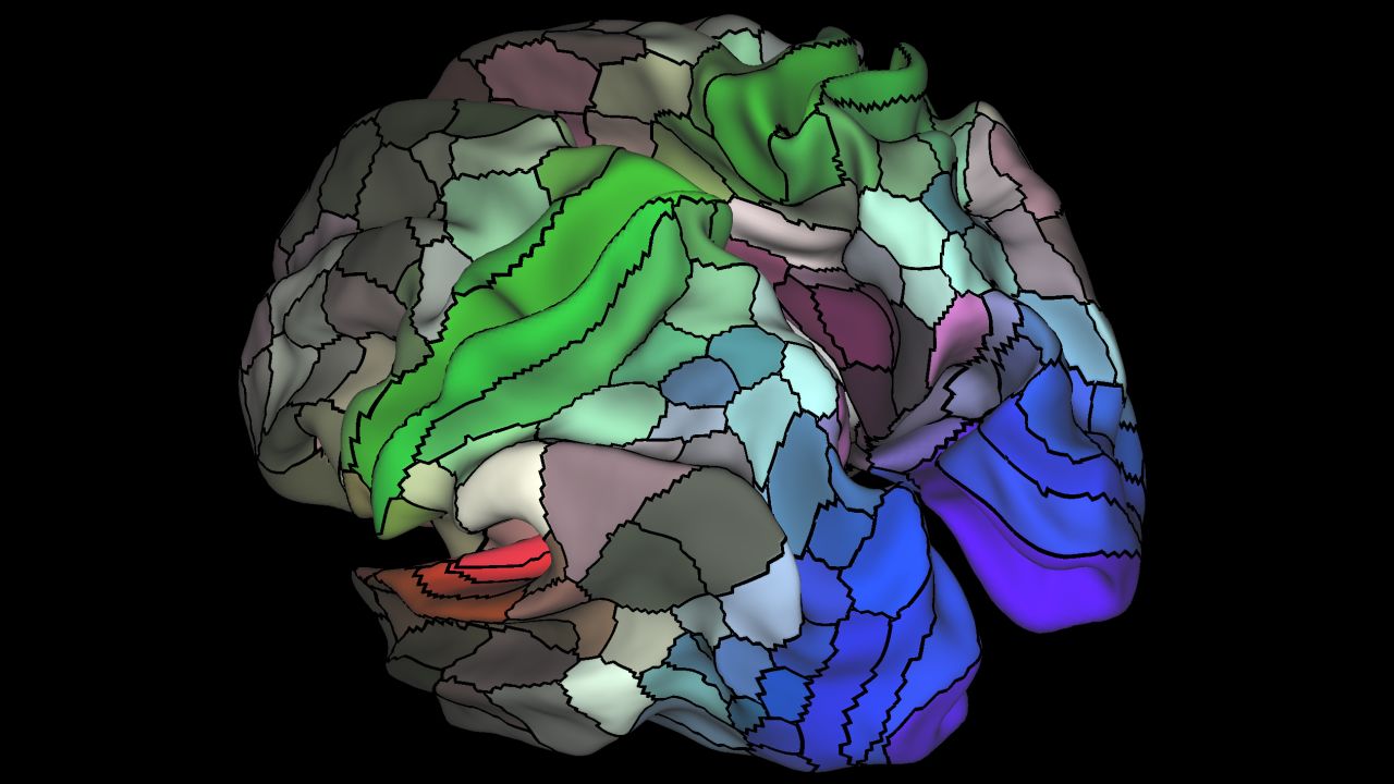 This image shows the pattern of brain activation (red, yellow) and deactivation (blue, green) in the left hemisphere when listening to stories while in the MRI scanner. 
