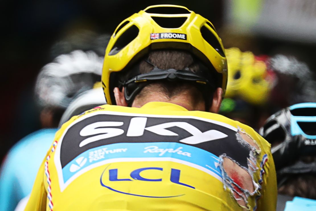 Chris Froome bears the scars of competition after falling during stage 18 in the Tour de France.
