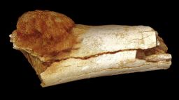 A  rendered image of an ancient foot bone fragment, showing a cancerous growth extending beyond the bone's surface. 