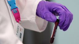 HARLOW, ENGLAND - JANUARY 19:  An analyst handles a vial of blood in the anti-doping laboratory which will test athlete's samples from the London 2012 Games on January 19, 2012 in Harlow, England. The facility, which will be provided by GSK and operated by King's College London, will test over 6250 samples throughout the Olympic and Paralympic Games. Over 150 anti-doping scientists will work in the laboratory, which measures the size of seven tennis courts, 24 hours a day.  (Photo by Oli Scarff/Getty Images)