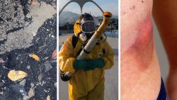Polluted water and the Zika virus had been the major health concerns in the run-up to the Rio Olympics.