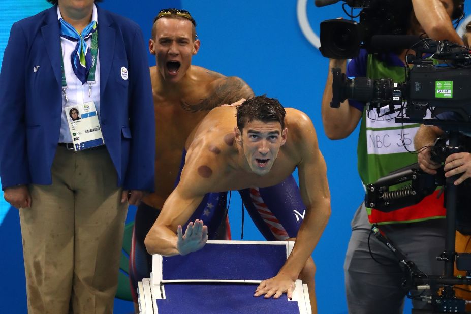 U.S swimmer Michael Phelps competes in the 4x100-meter freestyle relay on Sunday, August 7. The red marks on his body are <a href="http://www.cnn.com/2016/08/08/health/cupping-olympics-red-circles/index.html" target="_blank">the result of cupping</a> -- an ancient therapy that has mostly been used in Middle Eastern and Asian countries, especially China.