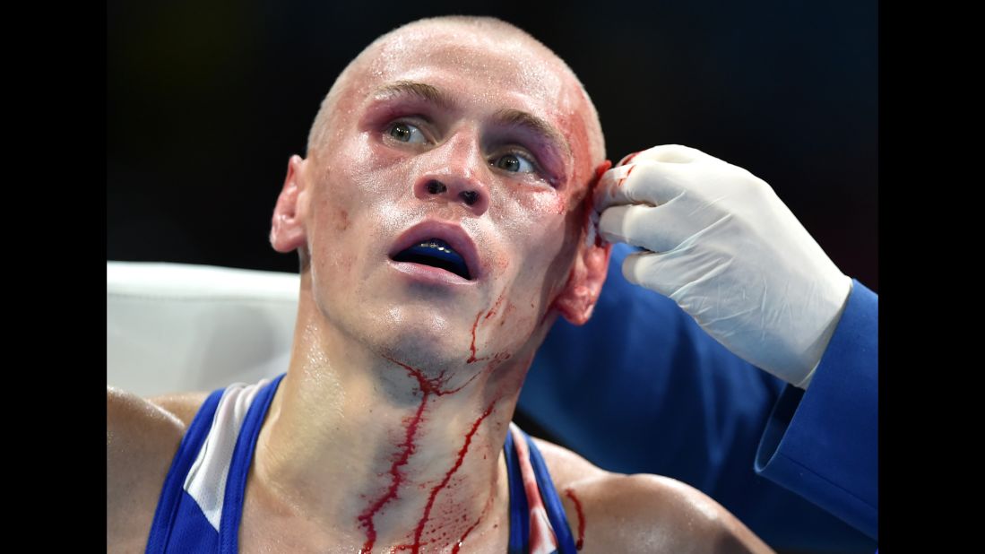 Russian boxer Vladimir Nikitin is attended to following an injury suffered in a bantamweight bout.