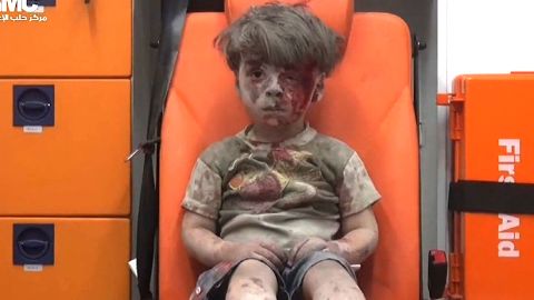 Omran Daqneesh, bloodied and covered with dust, sits in an ambulance after a strike in August.