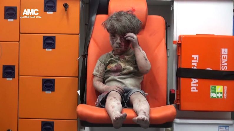 Omran silently wipes blood from his head in one of the last images we see in the video. He has since been released from the hospital. The doctor who treated him said his injury was light compared with the others wounded in the bombing.