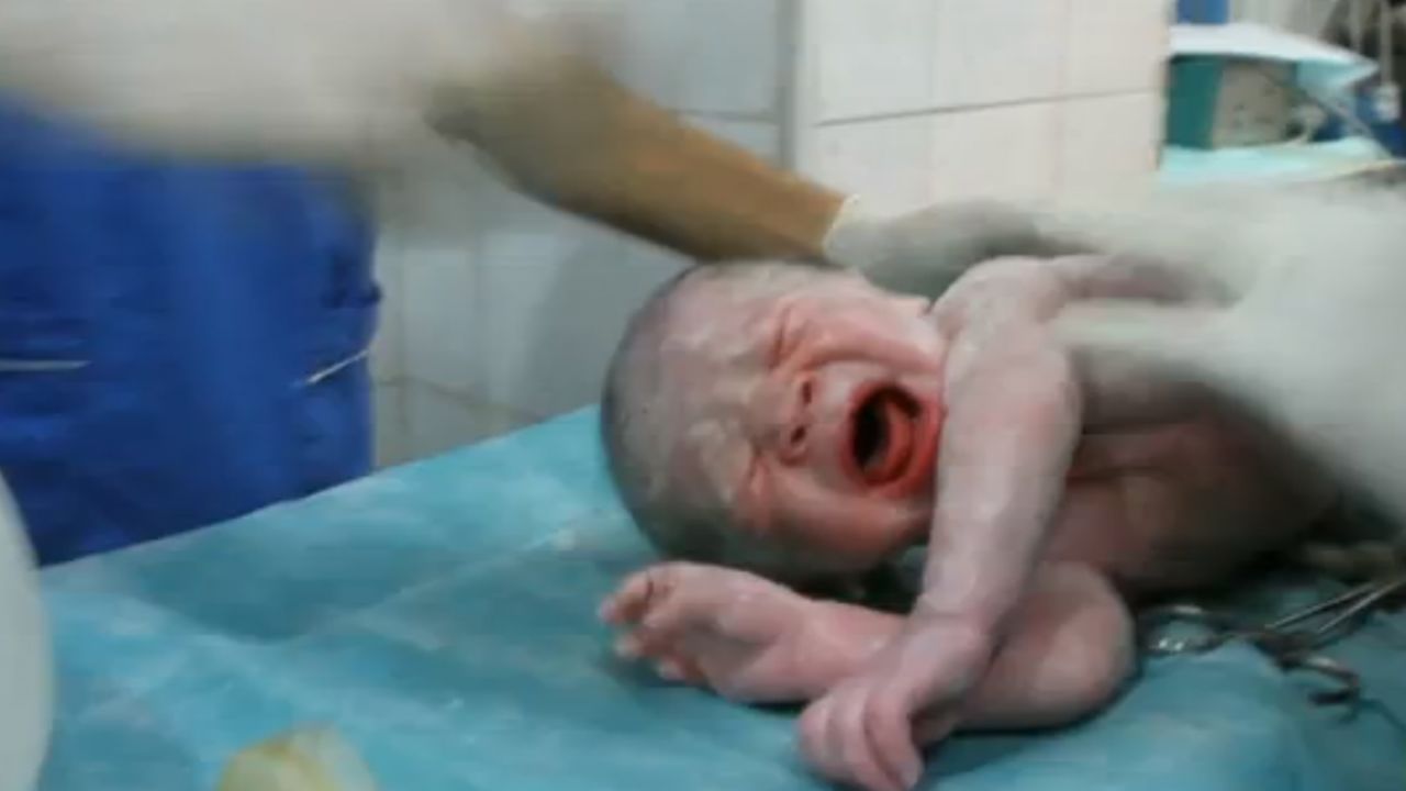 When doctors pulled the baby out he wasn't breathing.