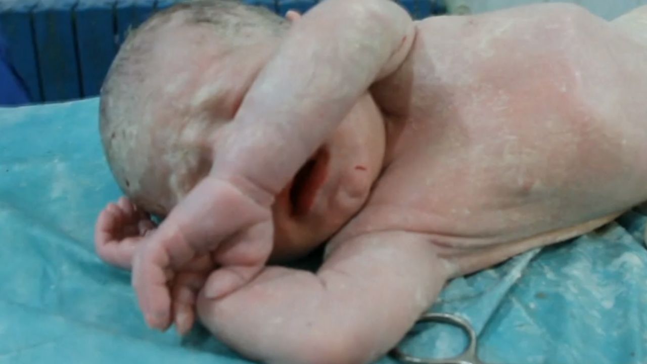 The boy takes his first breath and starts to cry.
