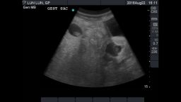 An ultrasound shows Lun Lun's two fetuses.