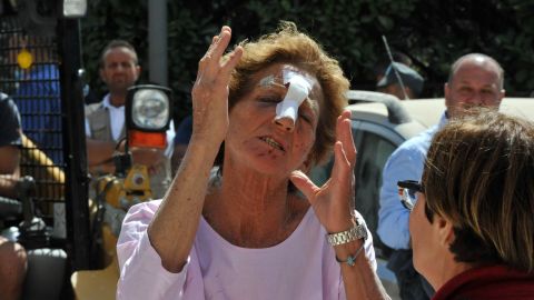 This woman in Amatrice was wounded during the earthquake.