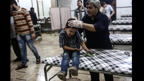 A boy receives medical attention after a reported airstrike in the rebel-held area of Douma, Syria, on Wednesday, September 7. The war in Syria is now in its fifth year. 