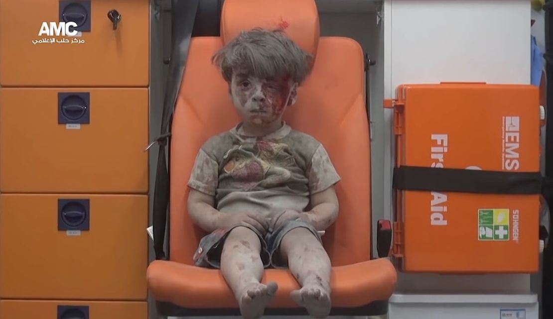 Recently the group helped distrubute this picture of Omran Daqneesh. The image of him, bloodied and silent while awaiting help, vividly reminded the world of the horrors those in Aleppo are facing.